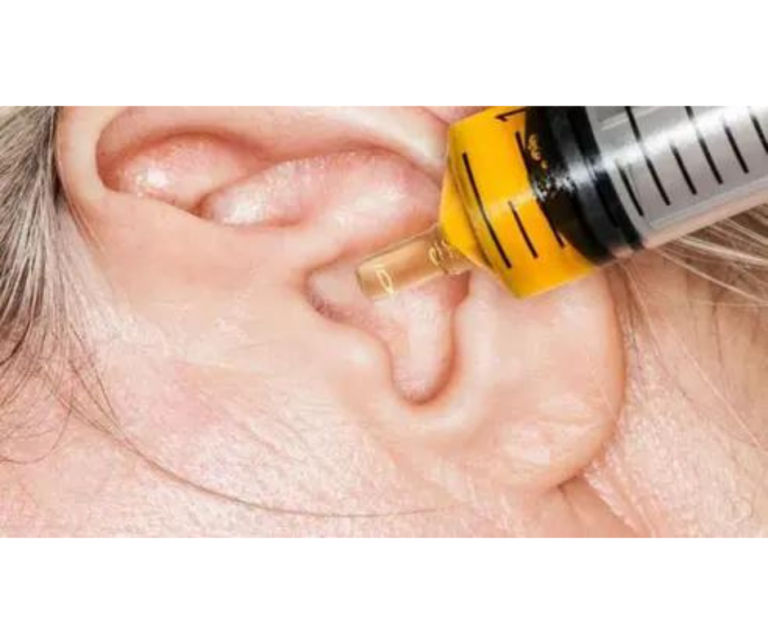 Poslije 4 sedmice upotrebe, zaboravit ćete šta je tinitus i poboljšati sluh, bez operacijeno…
